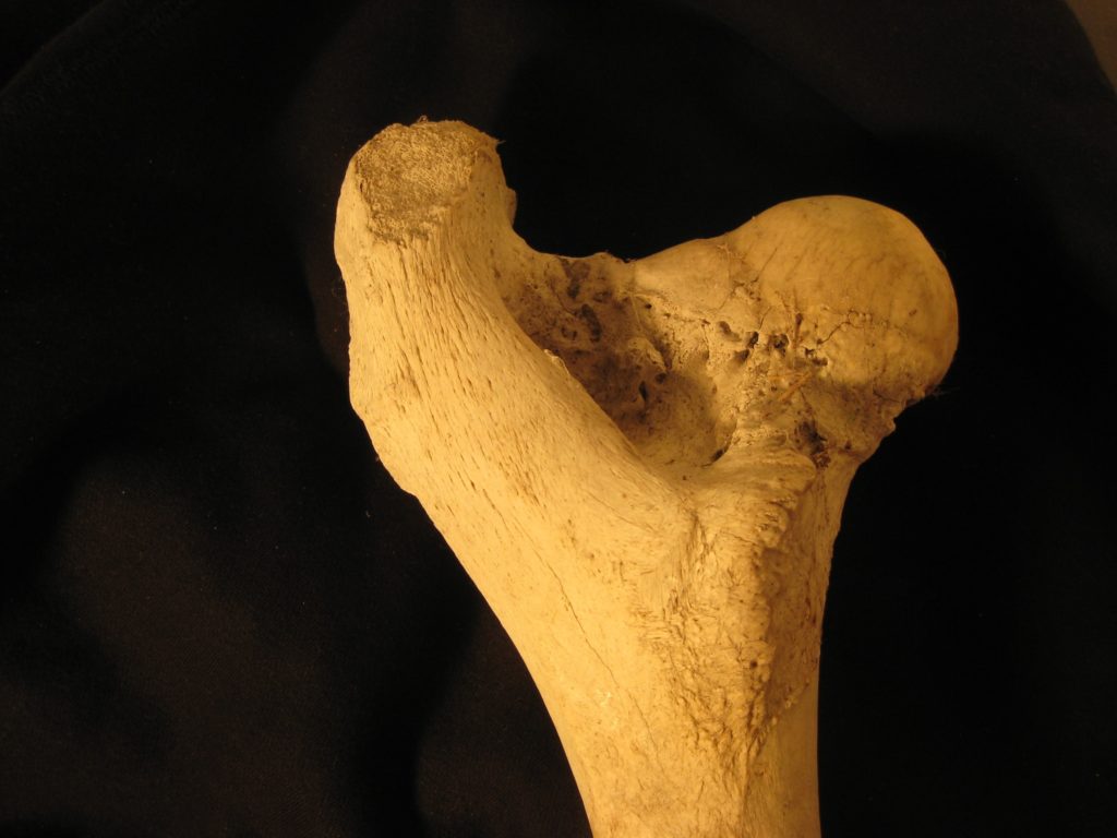 bone, femur, anatomy
